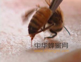 蜂蜜是个宝，巧用蜂蜜疗疾病！