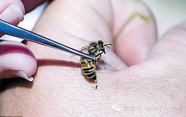 【秘】蜂针液即蜂毒的神奇功效