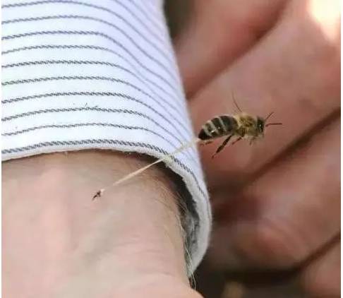 为什么蜜蜂蛰了人就会死呢？