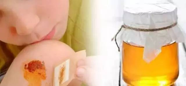 蜂蜜中风 柠檬蜂蜜水可以不放冰箱 什么蜂蜜对嗓子好 俄罗斯天然mea椴树蜂蜜 柠檬蜂蜜用什么蜂蜜