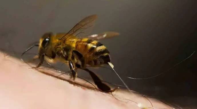 蜂毒疗法与人类健康 太神奇