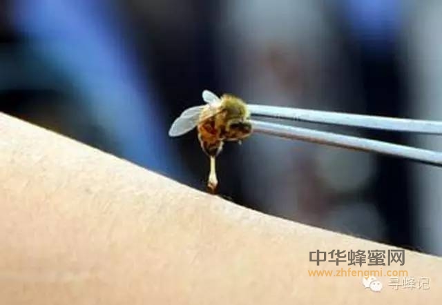 蜂蜜知道普及第八回：奇特医术——蜂疗！