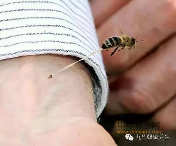 以毒攻毒，蜜蜂蜇人也能治病