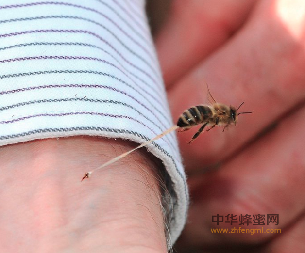 被蜂子蛰了怎么办 被蜂子蛰了肿了怎么办 被蜜蜂蛰了怎么处理 被黄蜂蛰了如何处理 被蜂蜇过敏图片 被蜂蜇了一般几天会好 被蜂蜇了之后如何处理