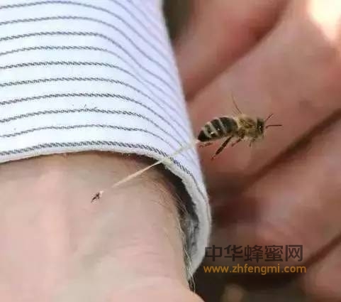 为什么蜜蜂蜇人就会死？