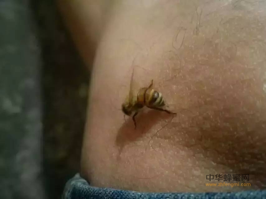 蜂毒——无毒副作用的活血、降压剂
