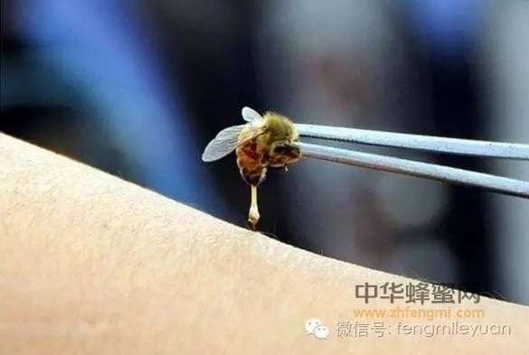 古老而神奇的蜂针疗法，你听过吗？