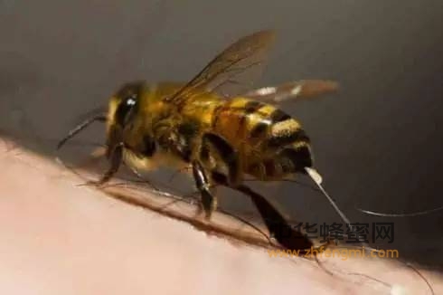 被蜜蜂蛰了应该怎么办？
