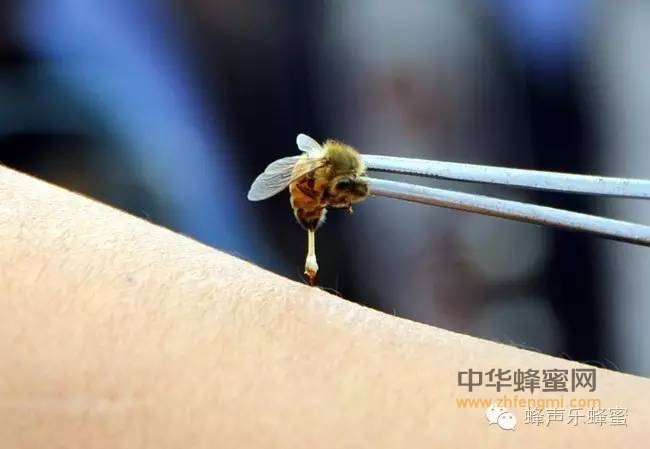 蜂毒——天然的抗生素