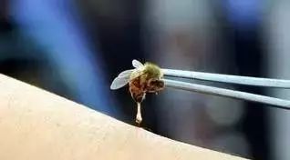 瘫痪女子被蜜蜂蜇1500次重新站立