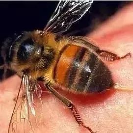 被蜜蜂蛰了之后怎么办？